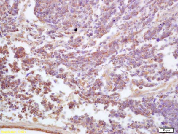 Immunohistochemistry (Formalin/PFA-fixed paraffin-embedded sections) - Anti-ADAM19 antibody (AB217758)