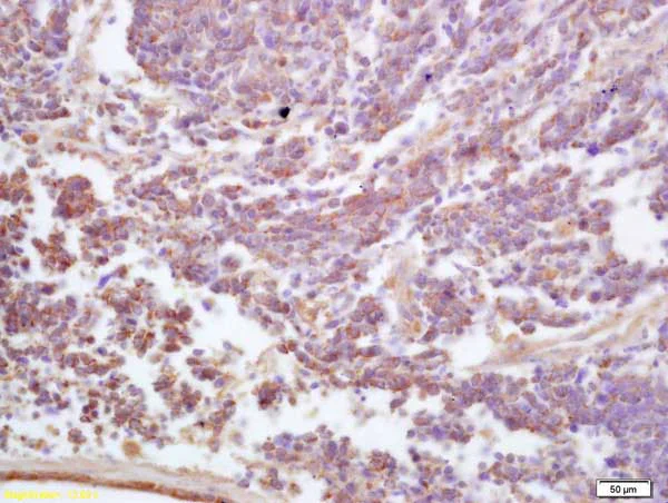Immunohistochemistry (Formalin/PFA-fixed paraffin-embedded sections) - Anti-ADAM19 antibody (AB217758)