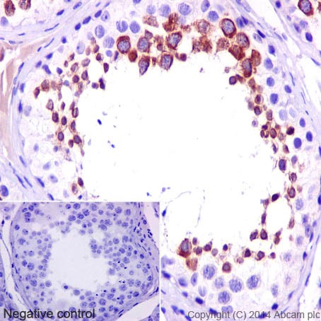Immunohistochemistry (Formalin/PFA-fixed paraffin-embedded sections) - Anti-ADAM2 antibody [EP15281] - BSA and Azide free (AB284849)