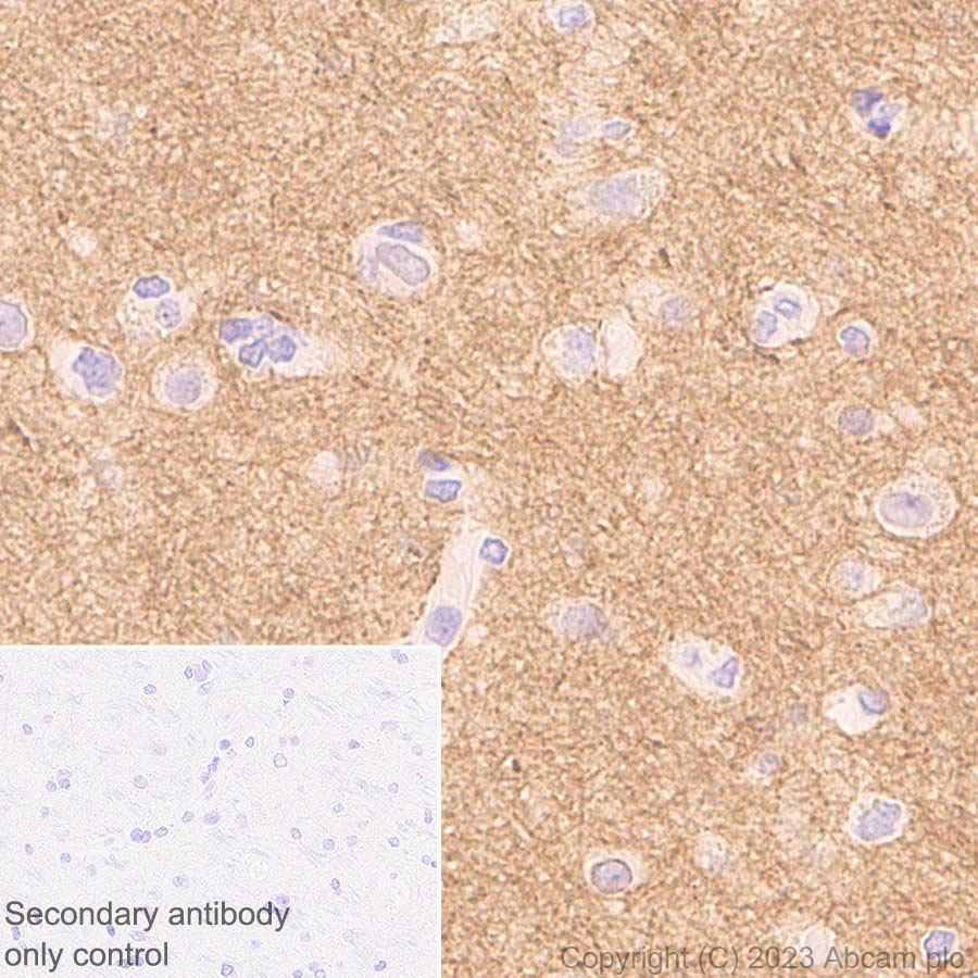Immunohistochemistry (Formalin/PFA-fixed paraffin-embedded sections) - Anti-ADAM22 antibody [EPR28037-56] - BSA and Azide free (ab314443), expandable thumbnail