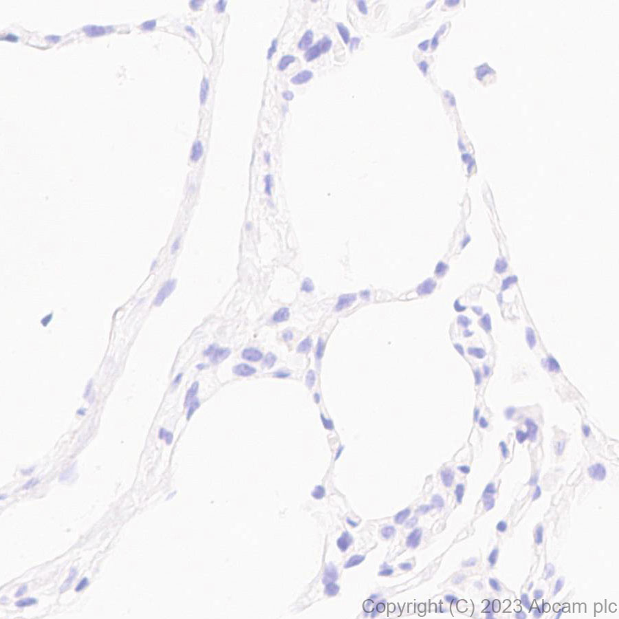 Immunohistochemistry (Formalin/PFA-fixed paraffin-embedded sections) - Anti-ADAM22 antibody [EPR28037-56] - BSA and Azide free (AB314443), expandable thumbnail
