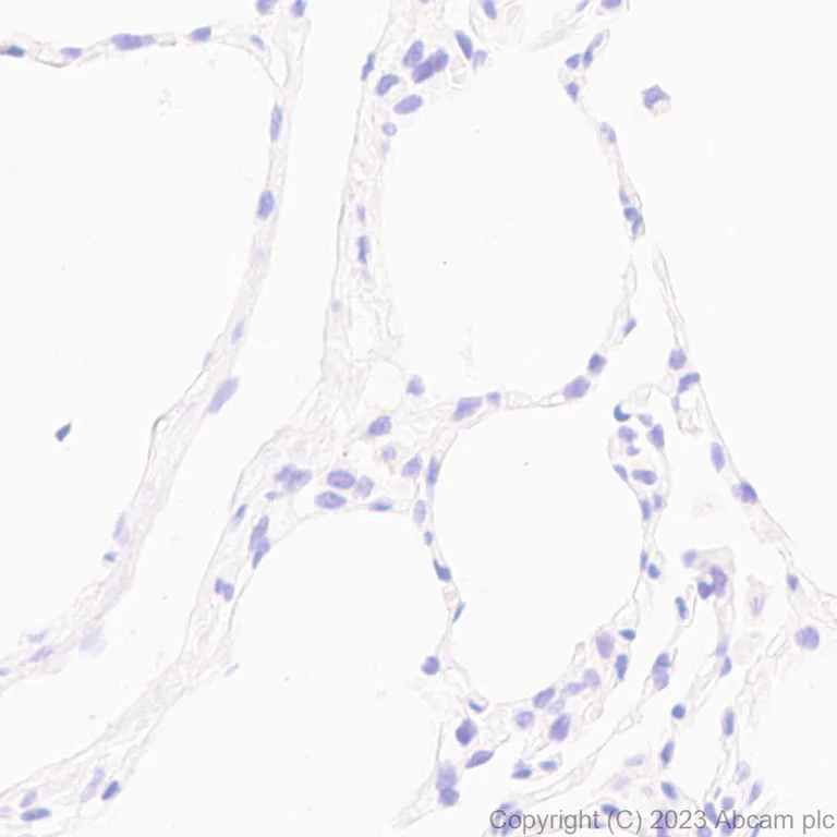 Immunohistochemistry (Formalin/PFA-fixed paraffin-embedded sections) - Anti-ADAM22 antibody [EPR28037-56] - BSA and Azide free (AB314443)