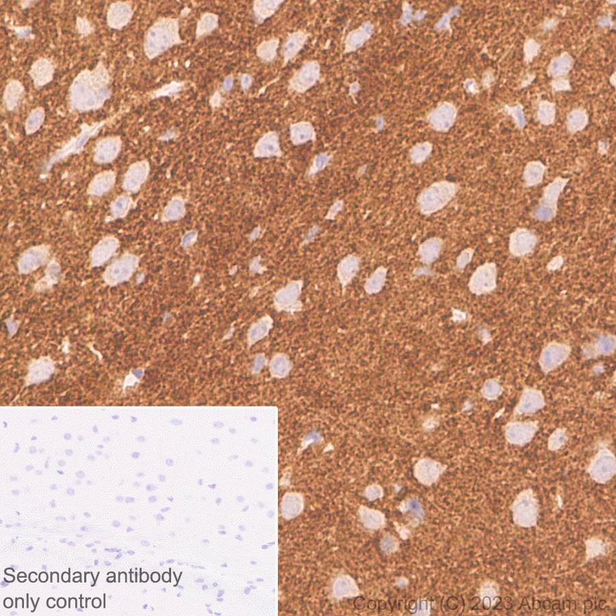 Immunohistochemistry (Formalin/PFA-fixed paraffin-embedded sections) - Anti-ADAM22 antibody [EPR28037-56] - BSA and Azide free (ab314443), expandable thumbnail