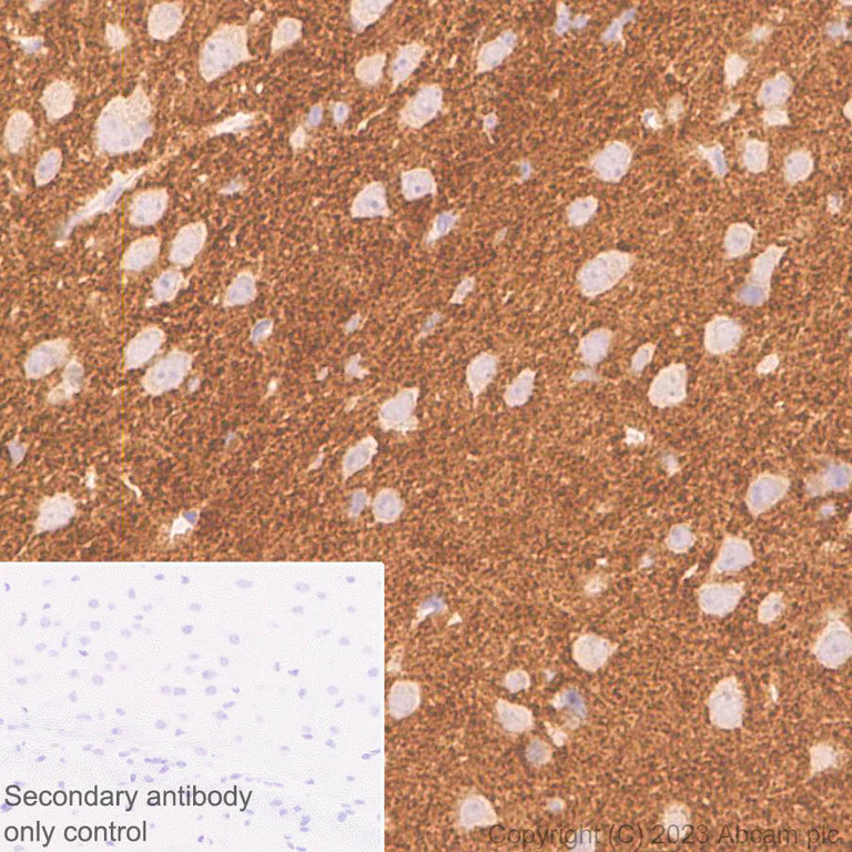 Immunohistochemistry (Formalin/PFA-fixed paraffin-embedded sections) - Anti-ADAM22 antibody [EPR28037-56] - BSA and Azide free (AB314443)