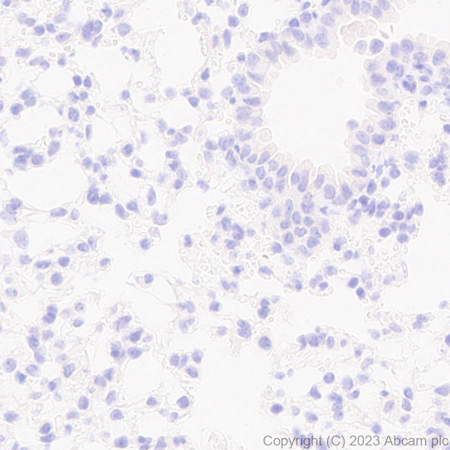 Immunohistochemistry (Formalin/PFA-fixed paraffin-embedded sections) - Anti-ADAM22 antibody [EPR28037-56] - BSA and Azide free (AB314443), expandable thumbnail