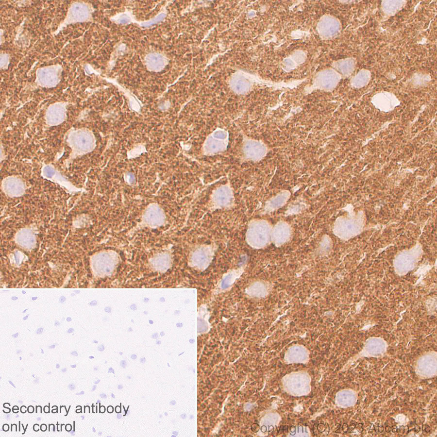 Immunohistochemistry (Formalin/PFA-fixed paraffin-embedded sections) - Anti-ADAM22 antibody [EPR28037-56] - BSA and Azide free (AB314443), expandable thumbnail