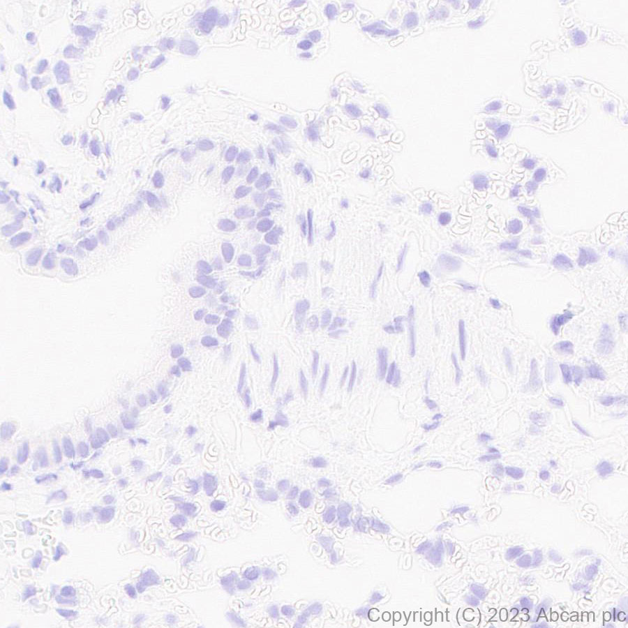 Immunohistochemistry (Formalin/PFA-fixed paraffin-embedded sections) - Anti-ADAM22 antibody [EPR28037-56] - BSA and Azide free (ab314443), expandable thumbnail