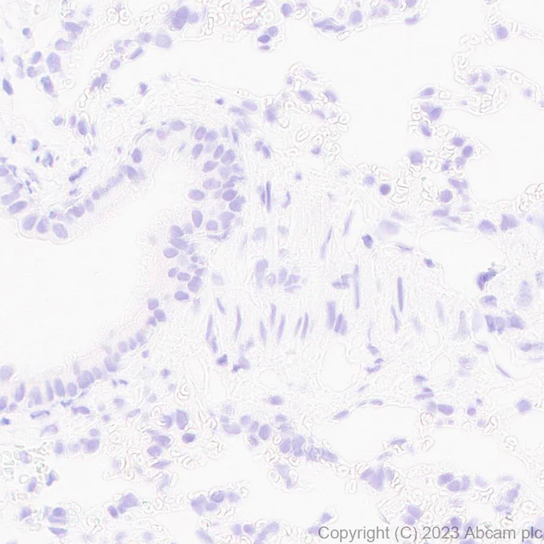 Immunohistochemistry (Formalin/PFA-fixed paraffin-embedded sections) - Anti-ADAM22 antibody [EPR28037-56] - BSA and Azide free (AB314443)