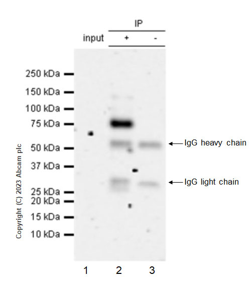 Immunoprecipitation - Anti-ADAM22 antibody [EPR28037-56] - BSA and Azide free (AB314443), expandable thumbnail