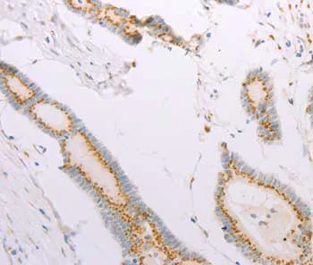Immunohistochemistry (Formalin/PFA-fixed paraffin-embedded sections) - Anti-ADAM28 antibody (AB198902)
