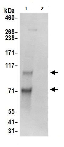 Immunoprecipitation - Anti-ADAM9 antibody (AB226459)