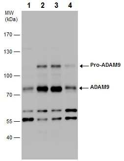 Western blot - Anti-ADAM9 antibody (AB227600)