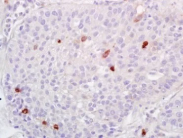 Immunohistochemistry (Formalin/PFA-fixed paraffin-embedded sections) - Anti-ADAMTS1 antibody (AB216977)