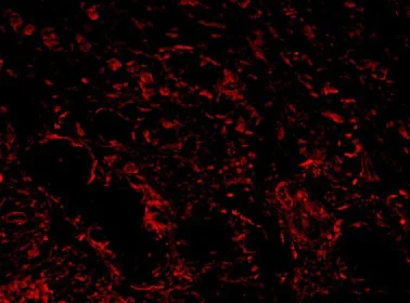 Immunohistochemistry (Formalin/PFA-fixed paraffin-embedded sections) - Anti-ADAMTS1 antibody (AB216977)