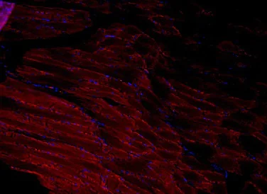 Immunohistochemistry (Formalin/PFA-fixed paraffin-embedded sections) - Anti-ADAMTS1 antibody (AB216977)