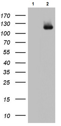 Western blot - Anti-ADAMTS1 antibody [OTI1B4] (AB236497)