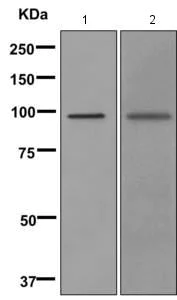 Western blot - Anti-ADAMTS10 antibody [EPR11860] (AB173290)