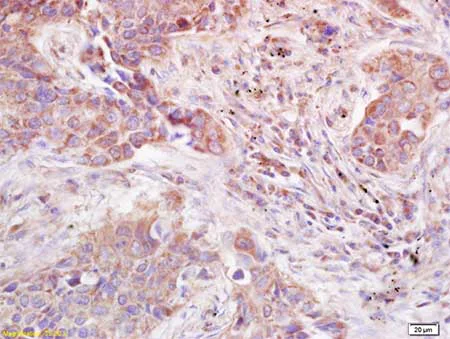 Immunohistochemistry (Formalin/PFA-fixed paraffin-embedded sections) - Anti-ADAMTS12 antibody (AB203102)