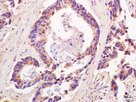Immunohistochemistry (Formalin/PFA-fixed paraffin-embedded sections) - Anti-ADAMTS12 antibody (AB203102)