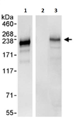 Immunoprecipitation - Anti-ADAMTS13 antibody (AB264161)