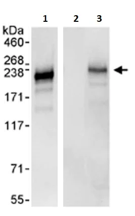 Immunoprecipitation - Anti-ADAMTS13 antibody (AB264161)