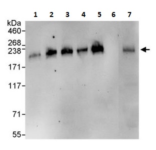 Immunoprecipitation - Anti-ADAMTS13 antibody (AB264162)