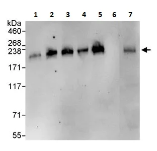 Immunoprecipitation - Anti-ADAMTS13 antibody (AB264162)