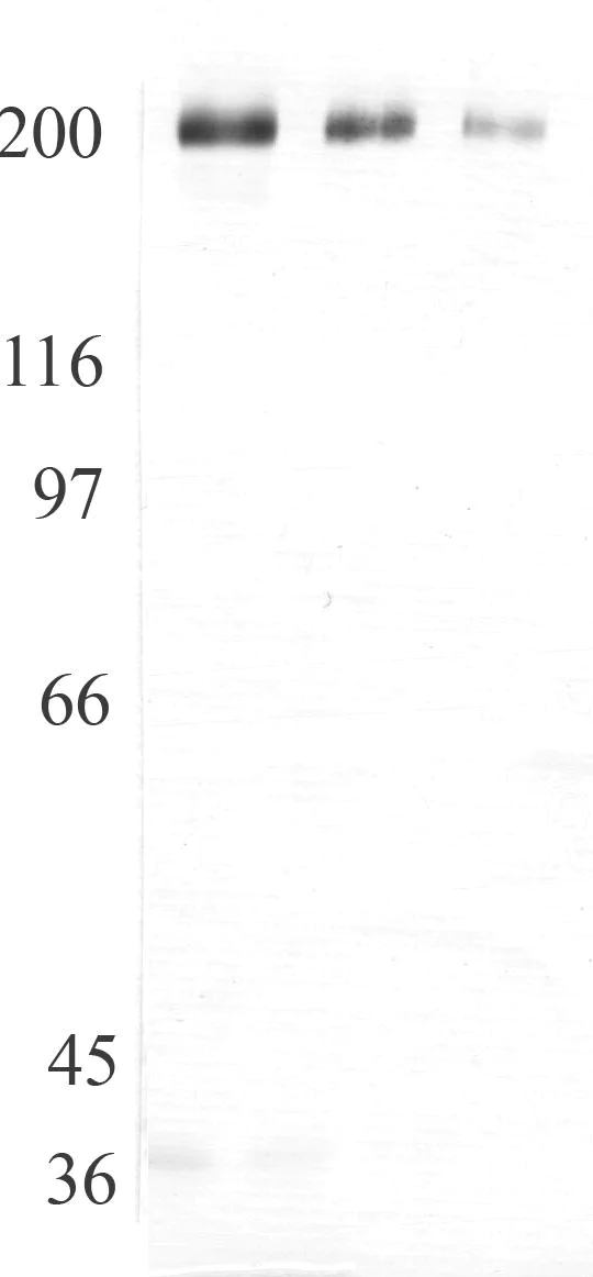 Western blot - Anti-ADAMTS13 antibody (AB28273)