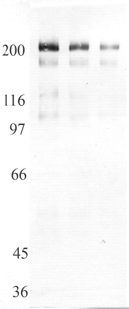 Western blot - Anti-ADAMTS13 antibody (AB28274)