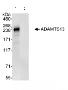 Immunoprecipitation - Anti-ADAMTS13 antibody (AB72335)
