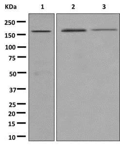 Western blot - Anti-ADAMTS13 antibody [EPR6132] (AB177940)