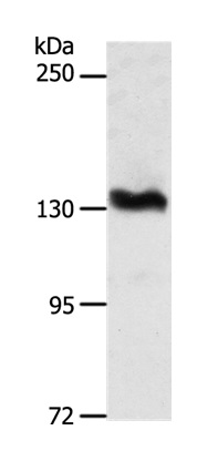 Western blot - Anti-ADAMTS16 antibody (AB198917)