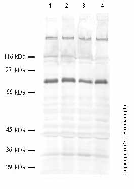 Western blot - Anti-ADAMTS16 antibody (AB45048)