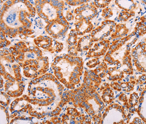 Immunohistochemistry (Formalin/PFA-fixed paraffin-embedded sections) - Anti-ADAMTS17 antibody (AB198881), expandable thumbnail