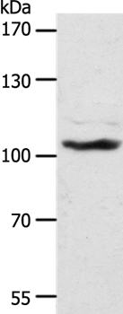 Western blot - Anti-ADAMTS17 antibody (AB198881), expandable thumbnail