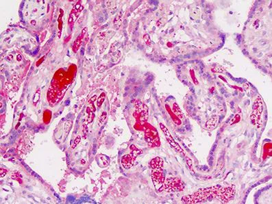 Immunohistochemistry (Formalin/PFA-fixed paraffin-embedded sections) - Anti-ADAMTS19 antibody (AB190073)