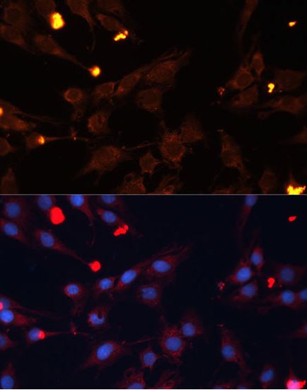 Immunocytochemistry/ Immunofluorescence - Anti-ADAMTS4 antibody (AB185722), expandable thumbnail