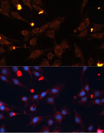 Immunocytochemistry/ Immunofluorescence - Anti-ADAMTS4 antibody (AB185722)