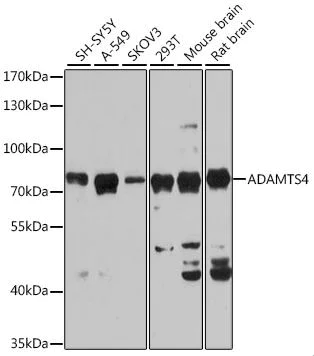 Western blot - Anti-ADAMTS4 antibody (AB185722)