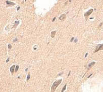 Immunohistochemistry (Formalin/PFA-fixed paraffin-embedded sections) - Anti-ADAMTS4 antibody (AB84792)