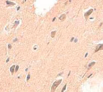 Immunohistochemistry (Formalin/PFA-fixed paraffin-embedded sections) - Anti-ADAMTS4 antibody (AB84792)