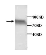 Western blot - Anti-ADAMTS4 antibody (AB84792)