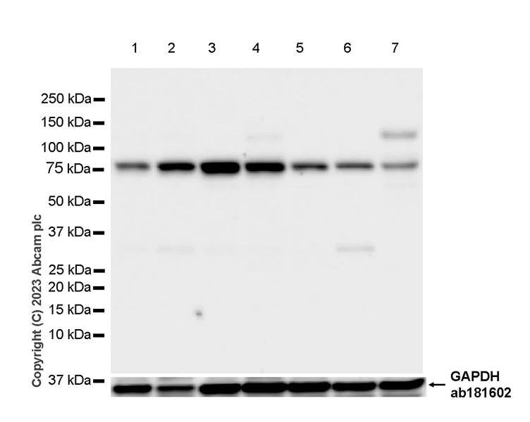 Western blot - Anti-ADAMTS4 antibody [EPR24094-30] - BSA and Azide free (AB314857)