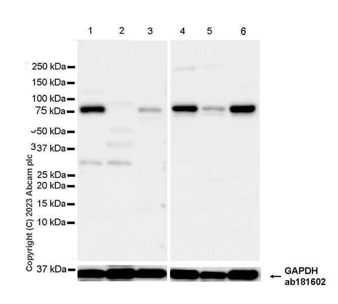 Western blot - Anti-ADAMTS4 antibody [EPR24094-30] - BSA and Azide free (AB314857)