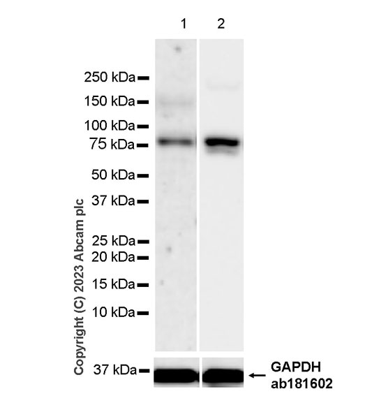 Western blot - Anti-ADAMTS4 antibody [EPR24094-30] - BSA and Azide free (AB314857)
