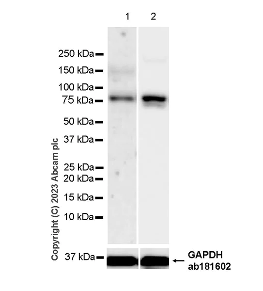 Western blot - Anti-ADAMTS4 antibody [EPR24094-30] - BSA and Azide free (AB314857)