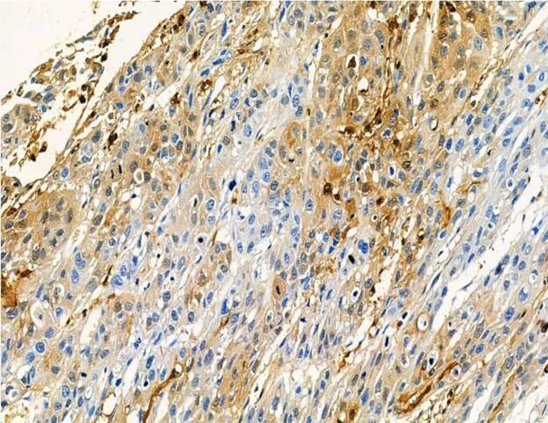 Immunohistochemistry (Formalin/PFA-fixed paraffin-embedded sections) - Anti-ADAMTS5 antibody (AB182795)