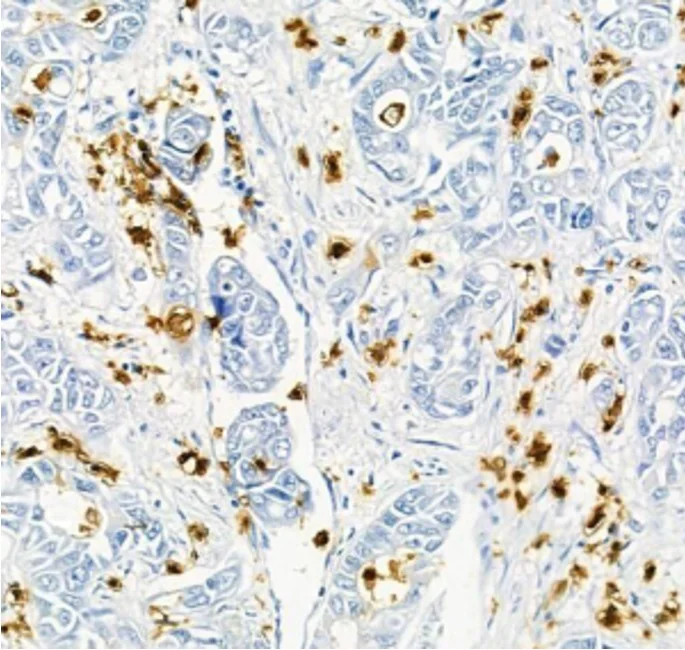Immunohistochemistry (Formalin/PFA-fixed paraffin-embedded sections) - Anti-ADAMTS5 antibody (AB182795)