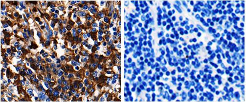 Immunohistochemistry (Formalin/PFA-fixed paraffin-embedded sections) - Anti-ADAMTS5 antibody (AB182795)