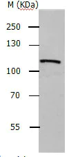 Western blot - Anti-ADAMTS5 antibody (AB182795)